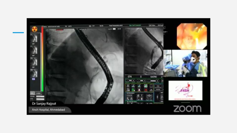 Surgery Trasmission (5)